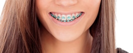 Orthodontics with Metal Braces